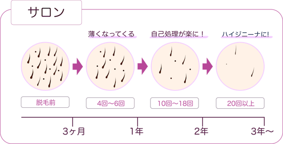 Vio脱毛の効果や完了までの回数や期間 経過は 医療脱毛だとハイジニーナは何回 部位 脱毛 おすすめ脱毛 サロン クリニックの比較 口コミ情報メディア