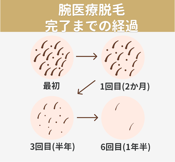 腕医療脱毛_効果経過