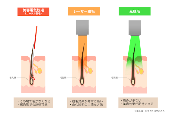 学生必見 学生におすすめ 全身脱毛サロン 医療クリニックをランキング形式で紹介 全身脱毛 脱毛 おすすめ脱毛 サロン クリニックの比較 口コミ情報メディア 学生必見 学生におすすめ 全身脱毛サロン 医療クリニックをランキング形式で紹介 全身脱毛 脱毛 おすすめ脱毛 サロン クリニックの比較 口コミ情報メディア