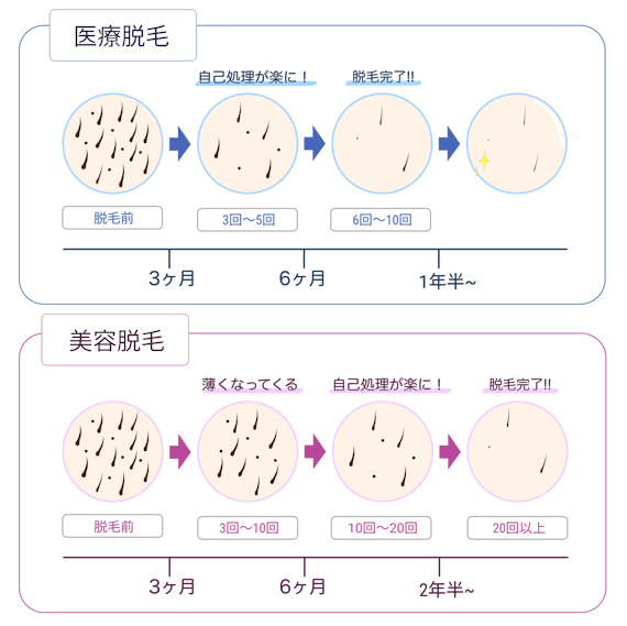 脱毛_経過