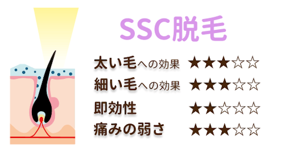 SSC脱毛_特徴