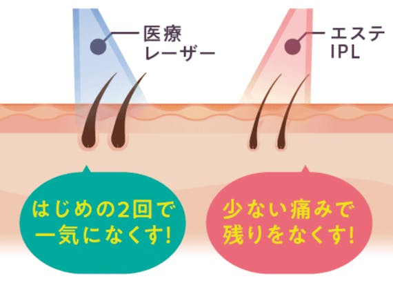 銀座カラー_レーザー+光_公式画像