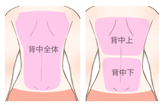 背中_医療脱毛‗範囲