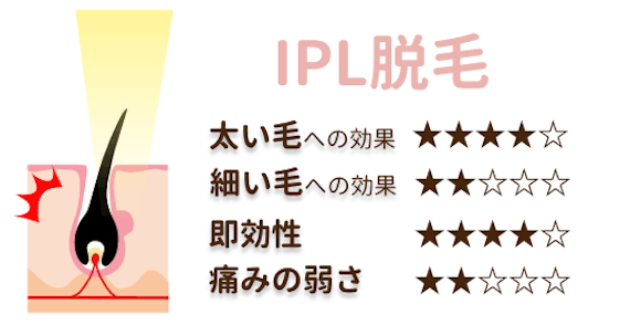 IPL_特徴