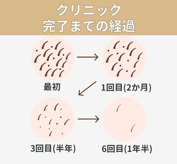ひげ_回数
