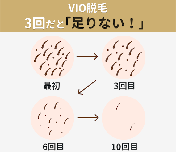 医療脱毛 経過