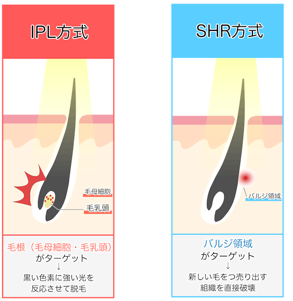 IPL_SHR