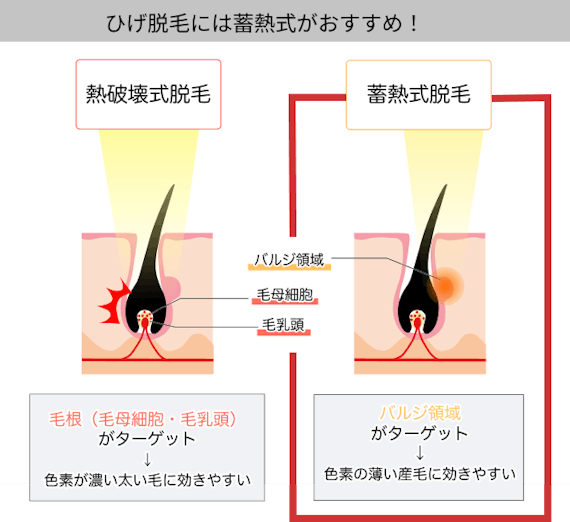 女性のひげ脱毛にはクリニックがおすすめ 自己処理の方法や回数 値段も徹底解説 部位 脱毛 おすすめ脱毛サロン クリニックの比較 口コミ情報メディア 女性のひげ脱毛にはクリニックがおすすめ 自己処理の方法や回数 値段も徹底解説 部位 脱毛 おすすめ脱毛サロン クリニックの比較 口コミ情報メディア