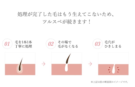 TBC_公式画像