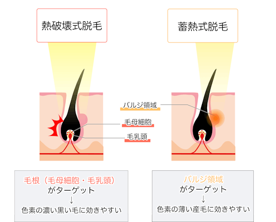 熱破壊式_蓄熱式
