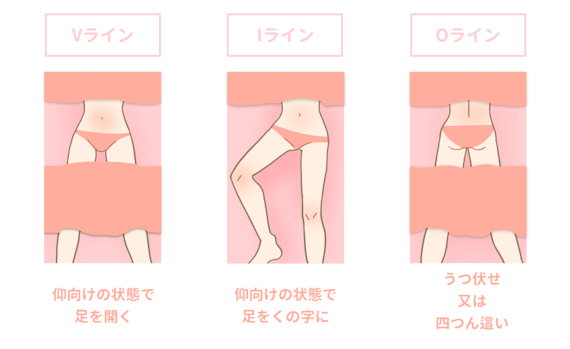 VIO_施術中体勢_figma