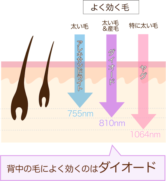 背中