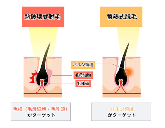 蓄熱式と熱破壊式の違い