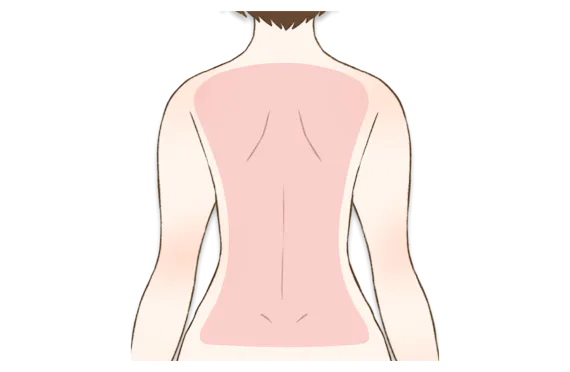 背中の医療脱毛におすすめのクリニック6選 安い 産毛に効果的なのはココ 部位 脱毛 おすすめ脱毛サロン クリニックの比較 口コミ情報メディア