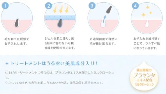 SSC方式_ミュゼ