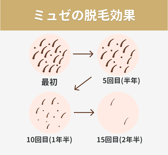 ミュゼ_脱毛効果
