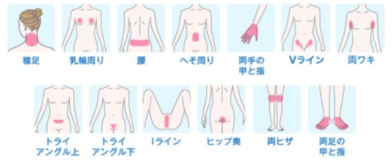 ミュゼ_セレクト_Sパーツ