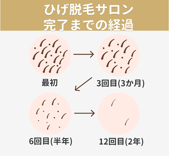 女性のひげの処理 脱毛どうする 自己処理の方法や回数 値段まで徹底解説 部位 脱毛 おすすめ脱毛サロン クリニックの比較 口コミ情報メディア 女性のひげの処理 脱毛どうする 自己処理の方法や回数 値段まで徹底解説 部位 脱毛 おすすめ脱毛サロン クリニックの比較 口コミ情報メディア
